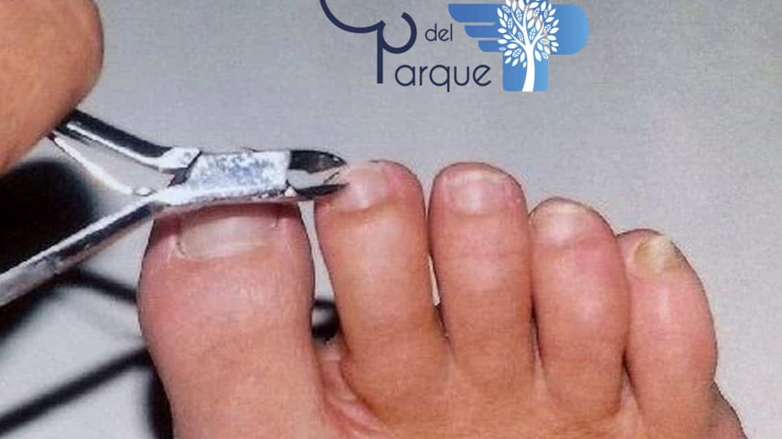¿Como cortarse las uñas?